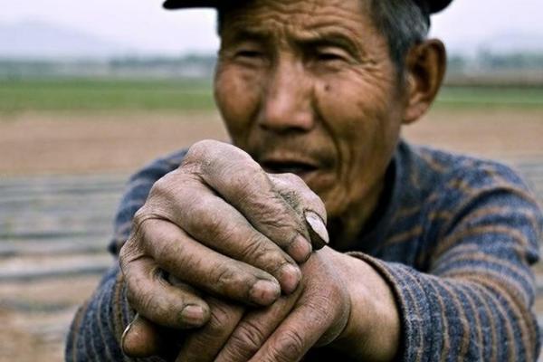 栀子花黄叶子什么原因 栀子花叶片发黄原因是什么?